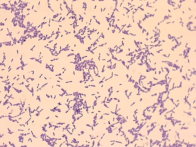 Stool-based biomarkers of interstitial cystitis/bladder pain syndrome